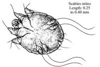 hewan scabies penyebab sakit gatal di pondok pesantren